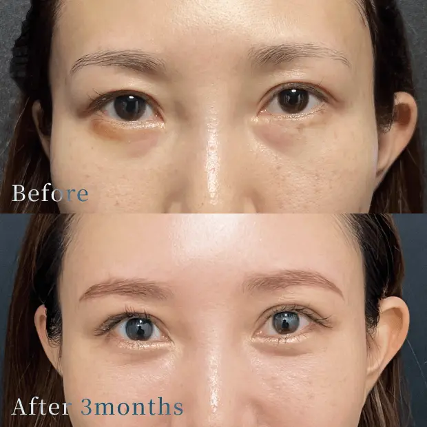 X CLINIC 症例写真 Before/After
