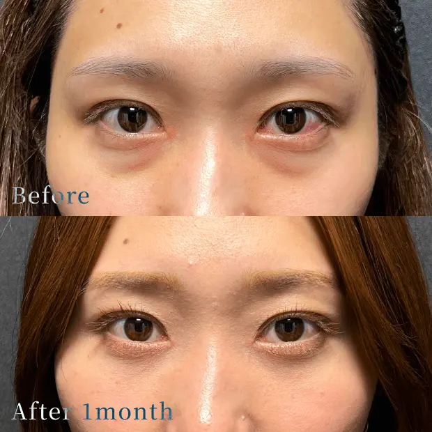 X CLINIC 症例写真 Before/After