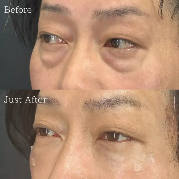 X CLINIC 症例写真 Before/After